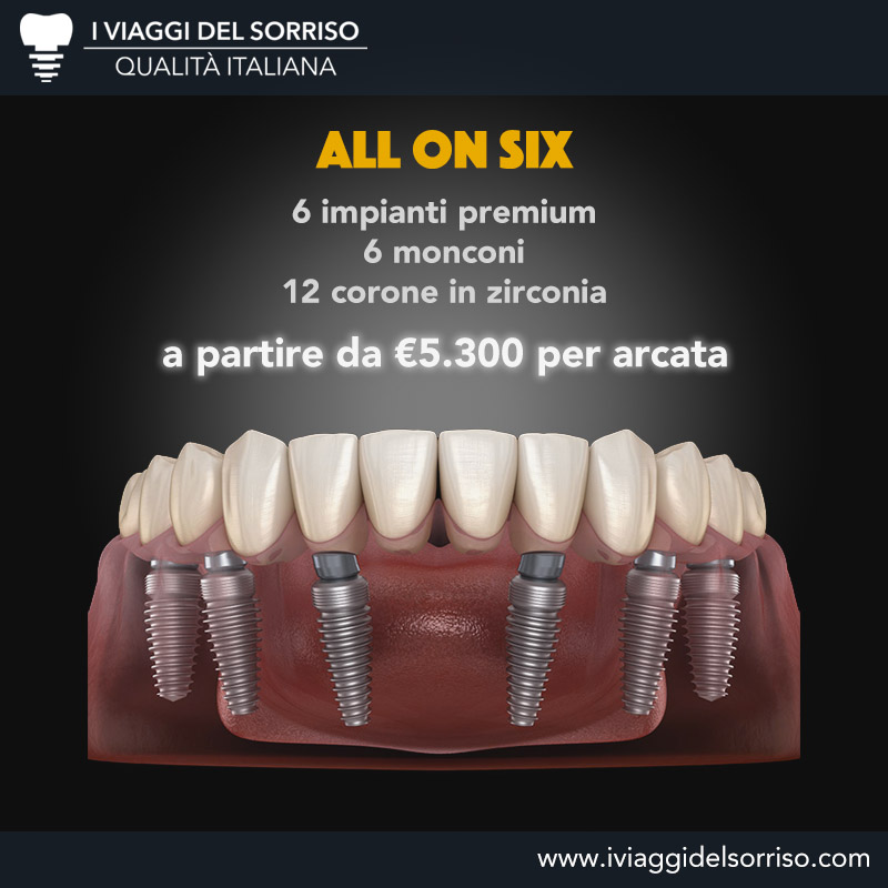 Risparmia oltre il 50% sui costi rispetto alle stesse cure dentali fatte in Italia